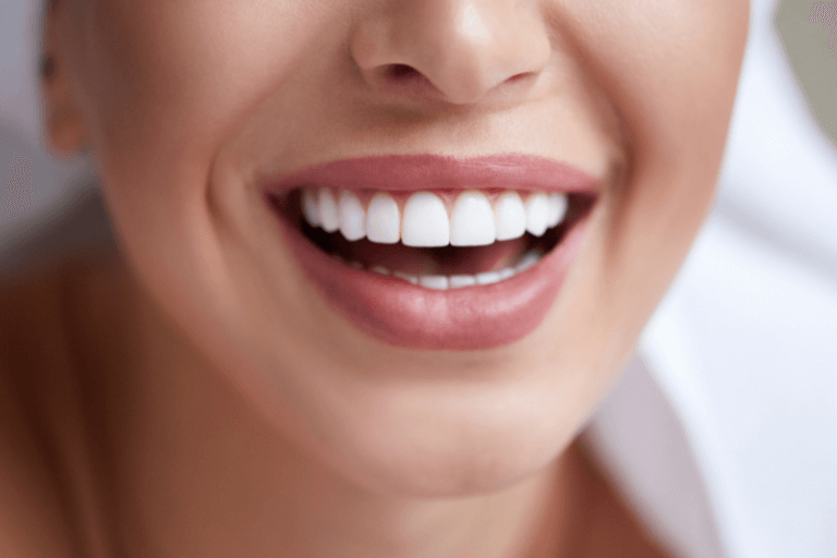woman smiling with bright white teeth after whitening at viva dental in carnforth